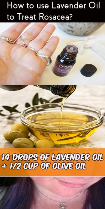lavender oil for rosacea