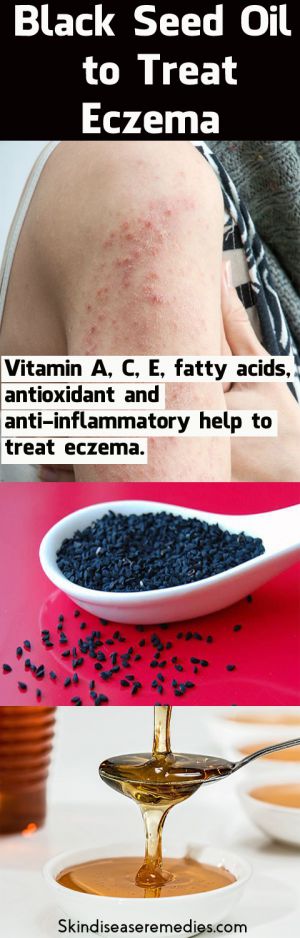 black seed for eczema