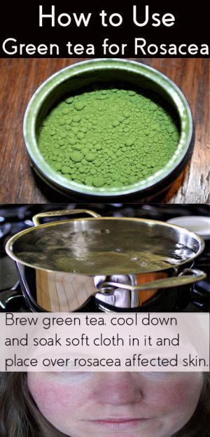 green tea for rosacea