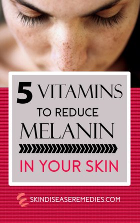 How to Reduce Melanin in Skin by Eating - 5 Vitamins Included