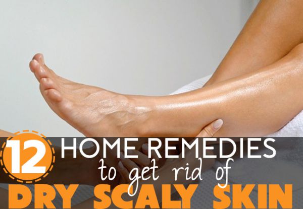 dry scaly skin on legs