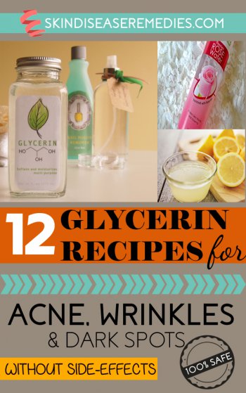 glycerin for skin, acne and wrinkles