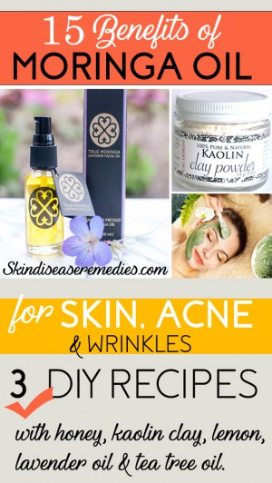 moringa oil for skin, acne