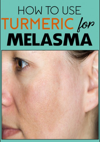turmeric for melasma