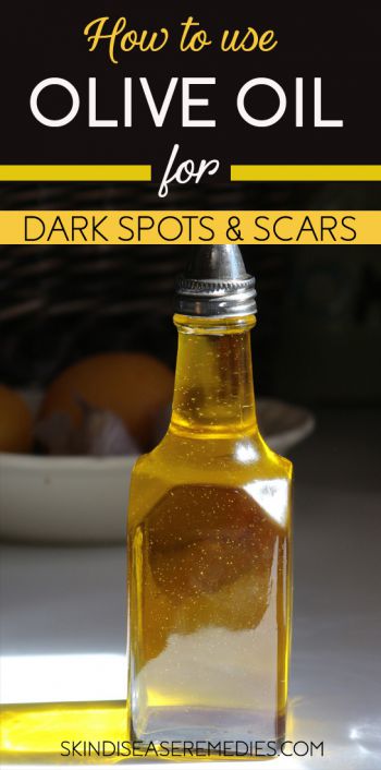 olive oil for dark spots