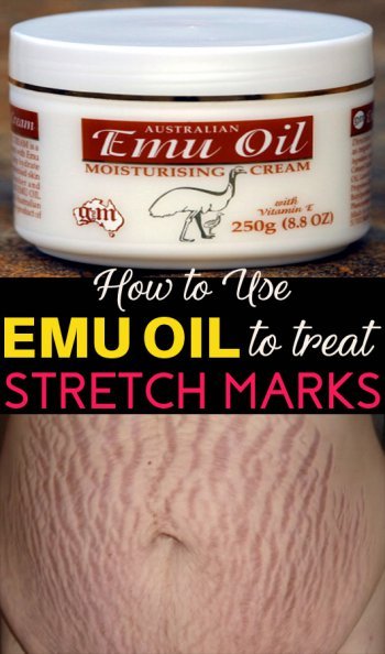 emu-oil-for-stretch-marks
