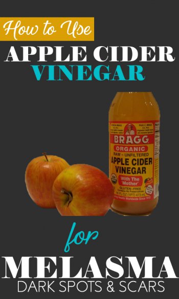 apple cider vinegar for melasma