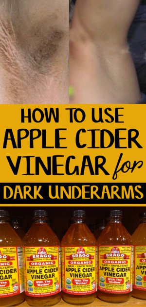 How to Use Apple Cider Vinegar for Dark Underarms – 9 DIY Methods