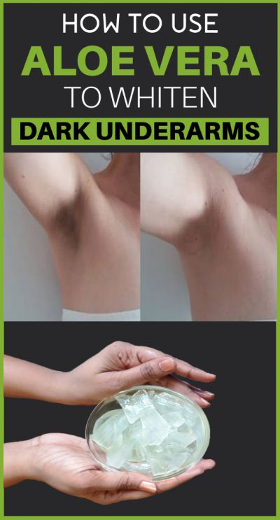 aloe vera for dark underarms