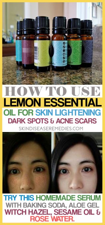 lemon essential oil for skin lightening