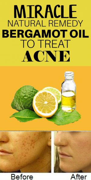 Bergamot Oil For Skin