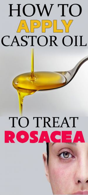 castor oil for rosacea