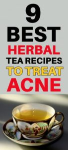Herbal Tea For Acne 137x300 