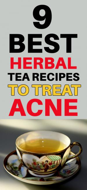 herbal tea for acne