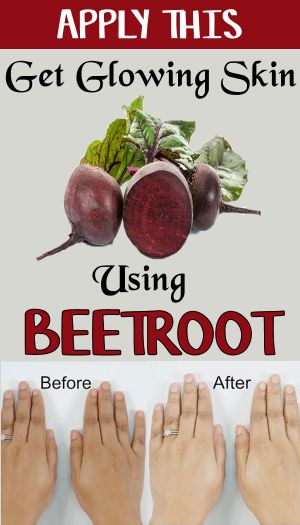 beetroot for skin whitening