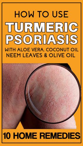 How to Use Turmeric for Psoriasis – 10 DIY Remedies