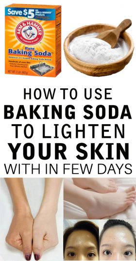 baking soda for skin whitening