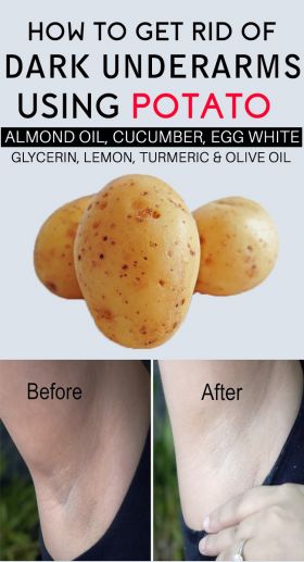 How to Use Potato for Dark Underarms – 12 Arm Whitening Recipes