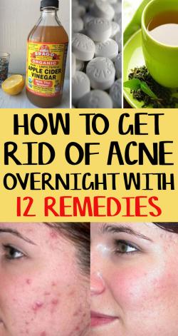 get rid of acne