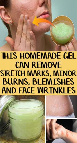 This Homemade Gel Can Remove Wrinkles, Stretch Marks, Blemishes And Burns