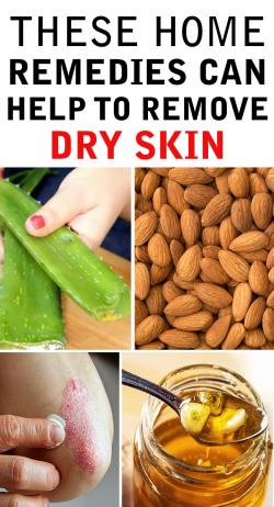 How to Get Rid of Dry Skin Naturally at Home