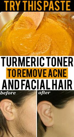 Turmeric Toner To Reduce Breakouts And Facial Hair