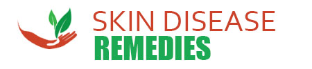 Skin Disease Remedies