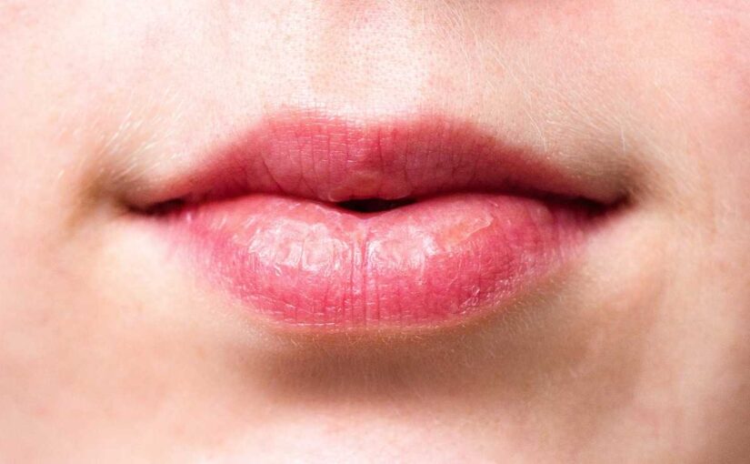 How To Make Your Lips Pink: Remedies & Tips To Follow