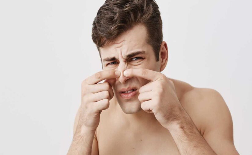 6 Easy DIY Remedies To Get Rid Of Pimples On The Nose